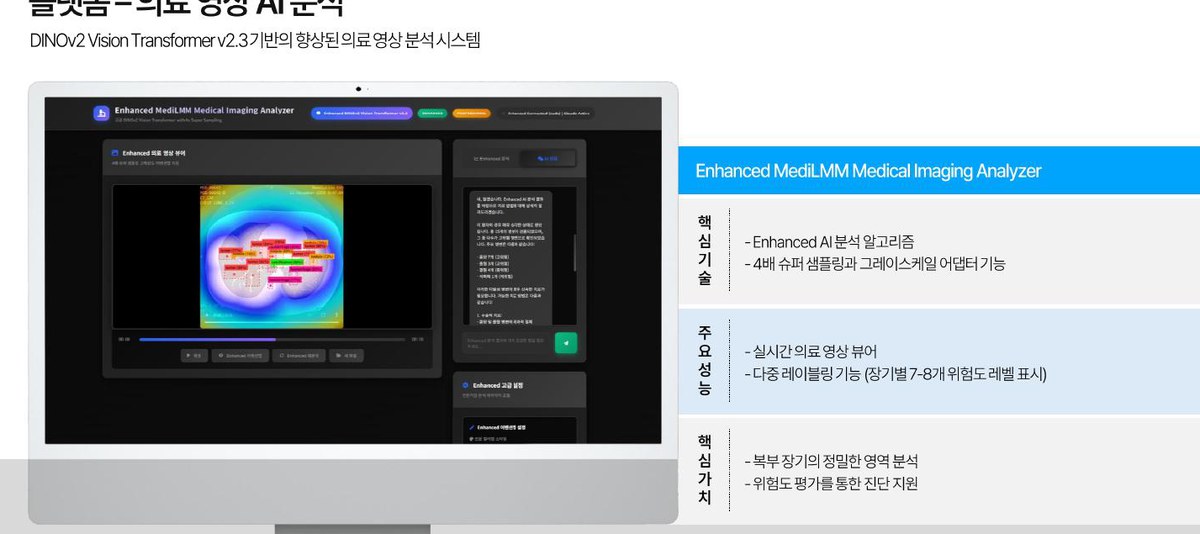 Enhanced MediLMM Medical Imaging Analyzer